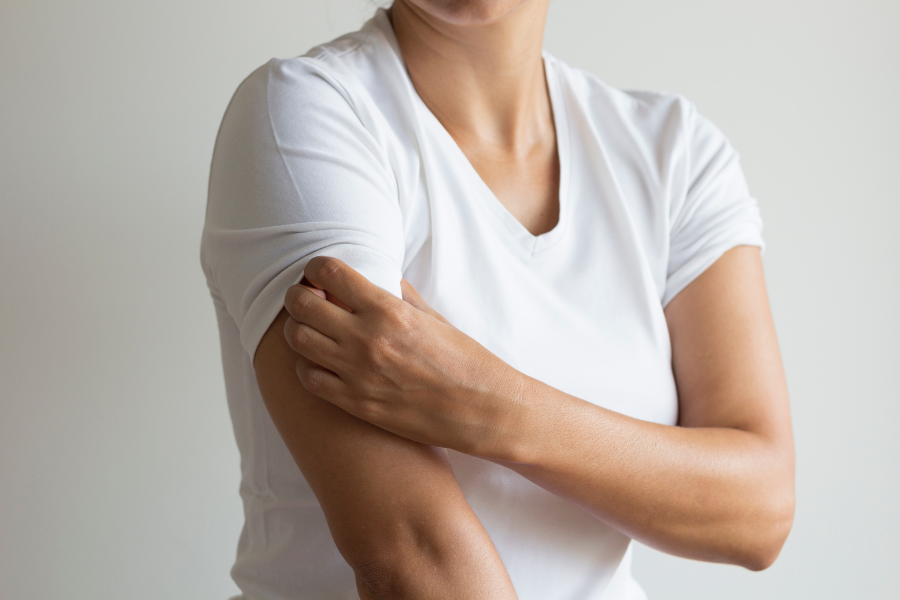 dermatitis atopica